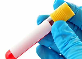 Can Scientists Determine Life Longevity With A Simple Blood Test?