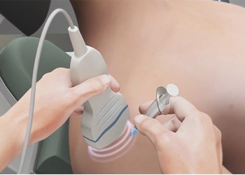 Shoulder Injections are detrimental to rotator cuff tears